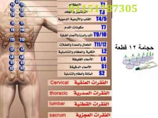 حجامة اسلامية طبية 12 قطعه لإمتصاص السموم