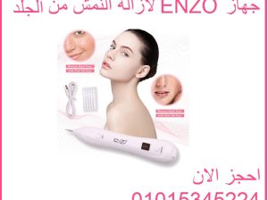 جهاز ENZO لازالة النمش من الجلد